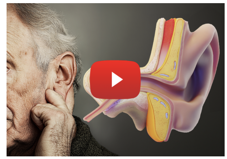click here to watch video