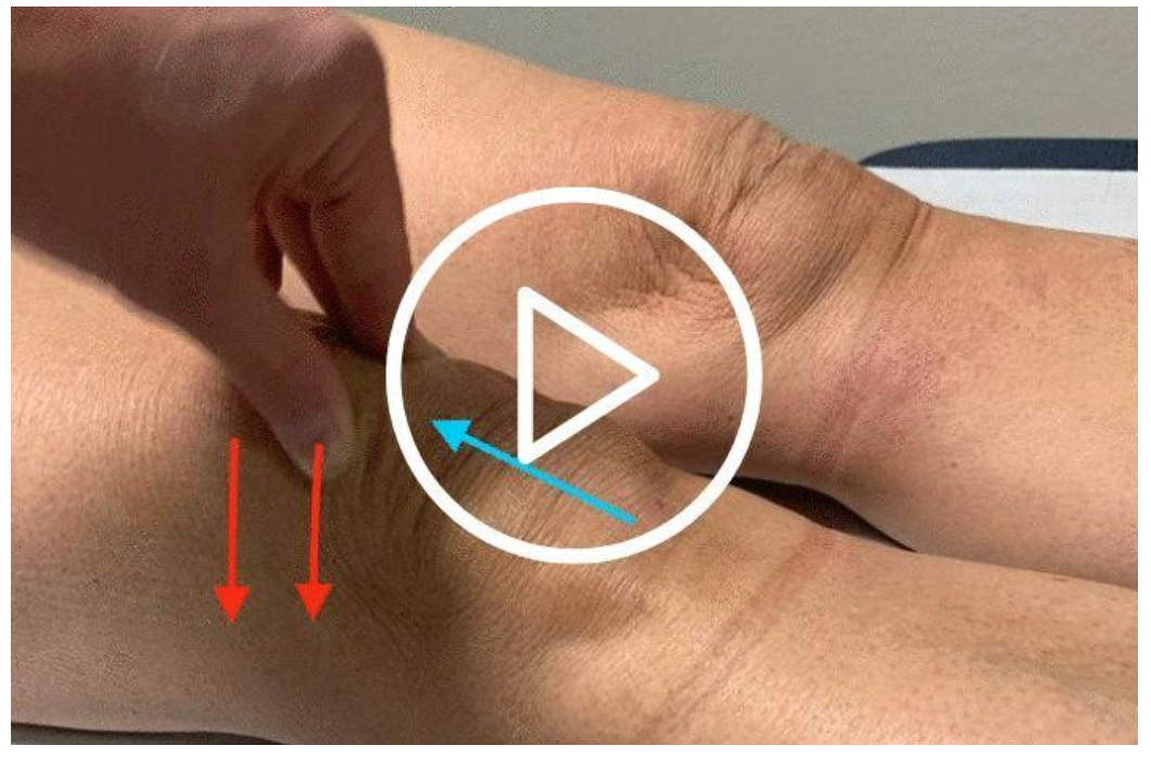 click here to watch video