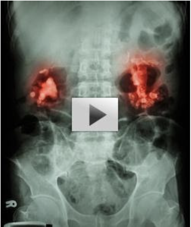 click here to learn more