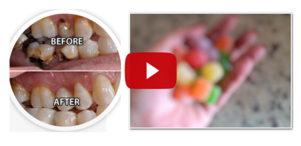 click here to watch video