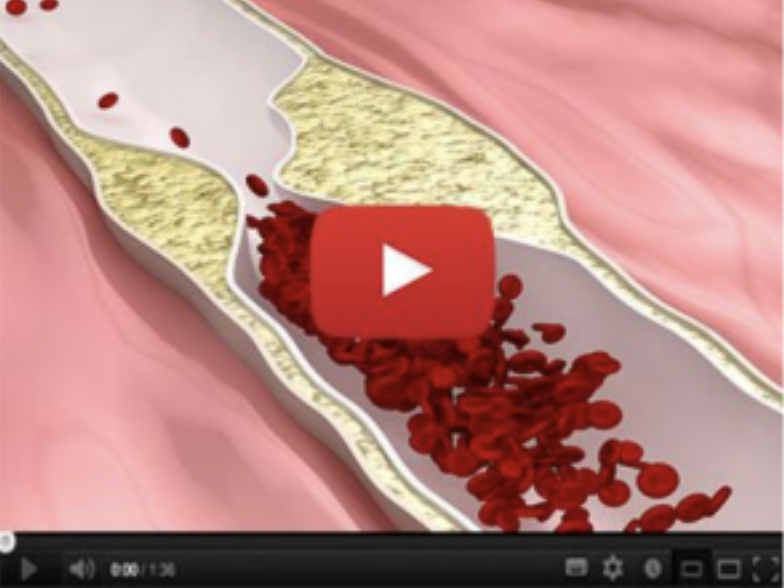 click here to learn more